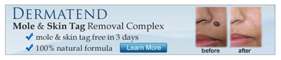 Dermatend Mole & Skin Tag Removal.